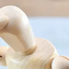 頭痛