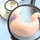胃腸炎